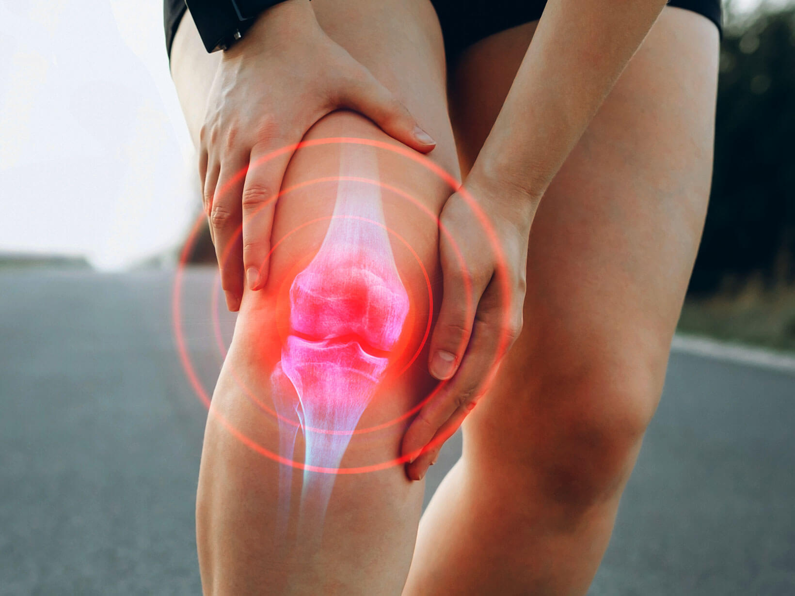 Magnetfeld-Therapie bei Knie-Arthrose?